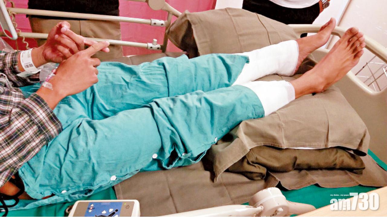 59歲婦墮化寶爐 留醫3日不治