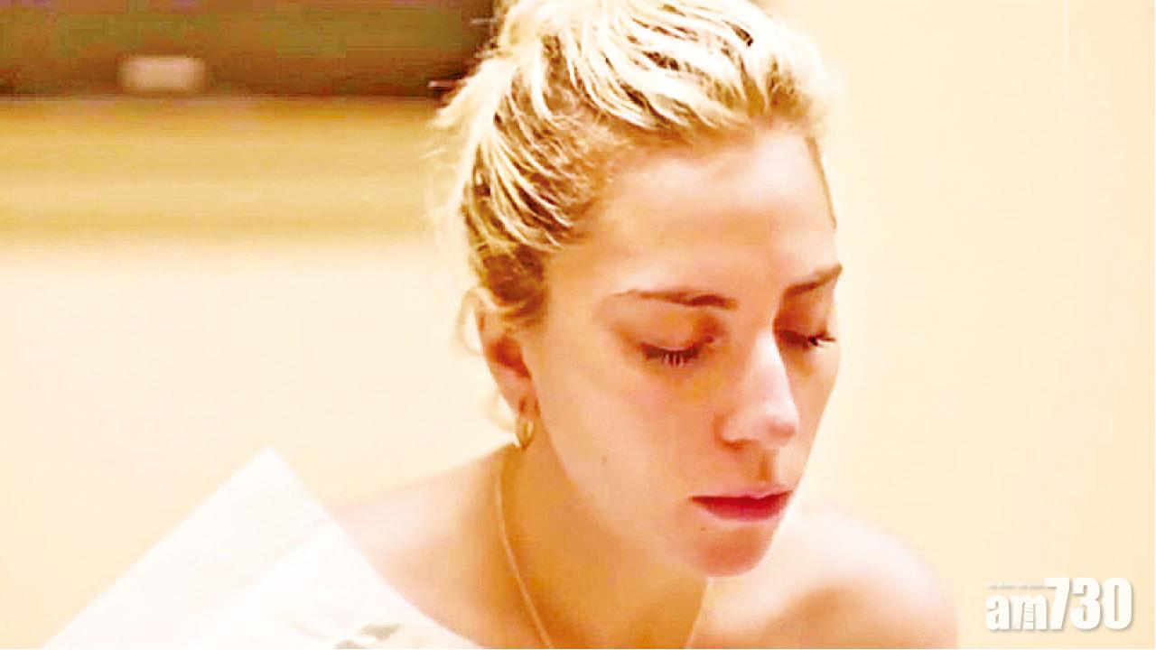 Lady Gaga病纏身 憂無法生BB