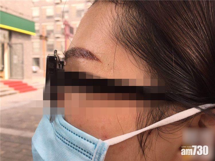 陝女紋眉除痣花27萬 美容師：可以開運