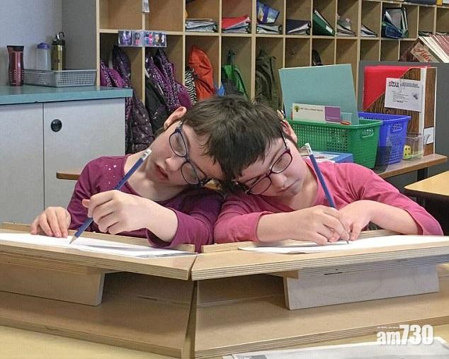 心腦眼四肢互通 誓不分姊妹花