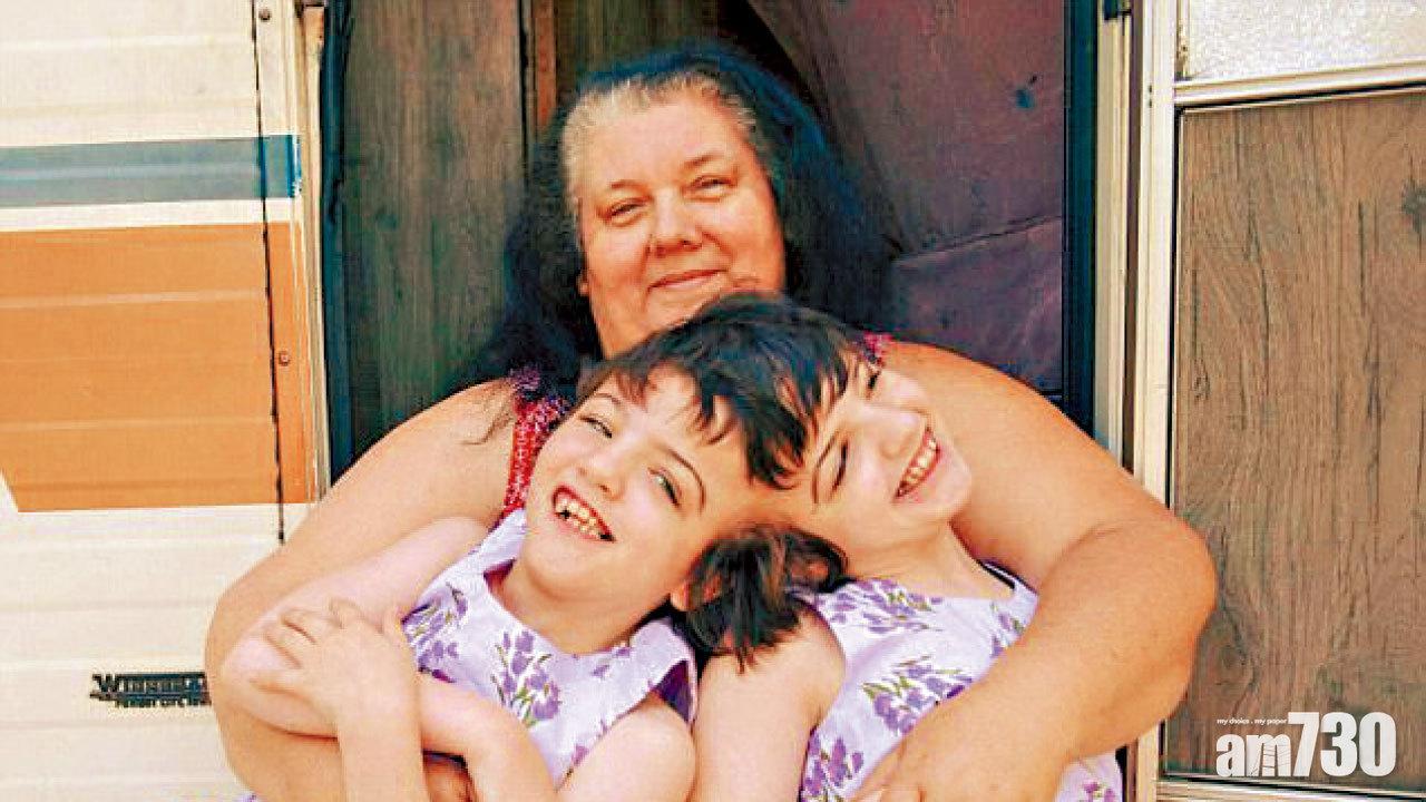 心腦眼四肢互通 誓不分姊妹花