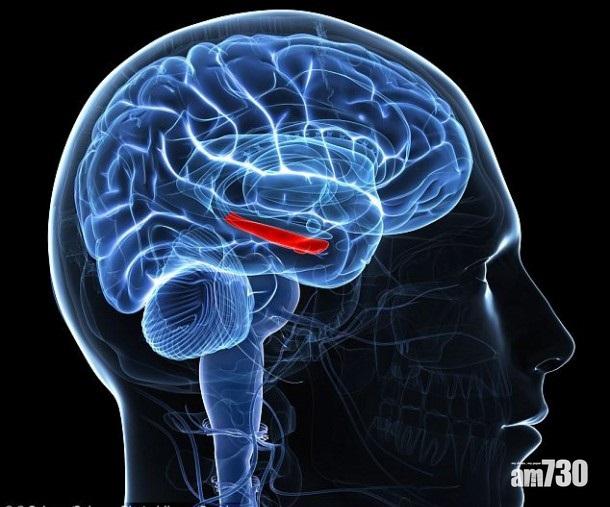 記憶義肢激發腦力