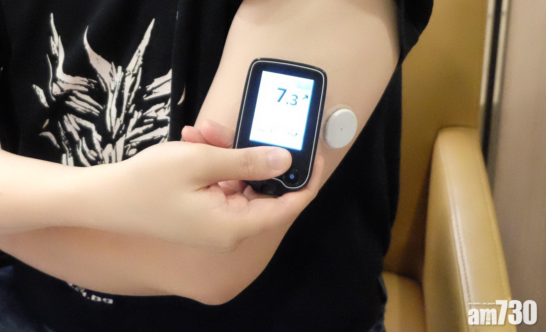 免拮手指加強自我監測血糖