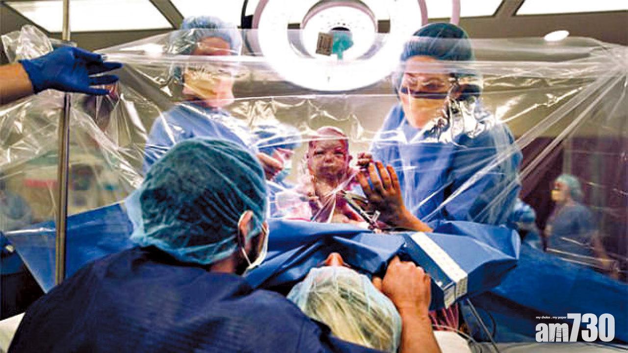 透明分娩抗抑鬱