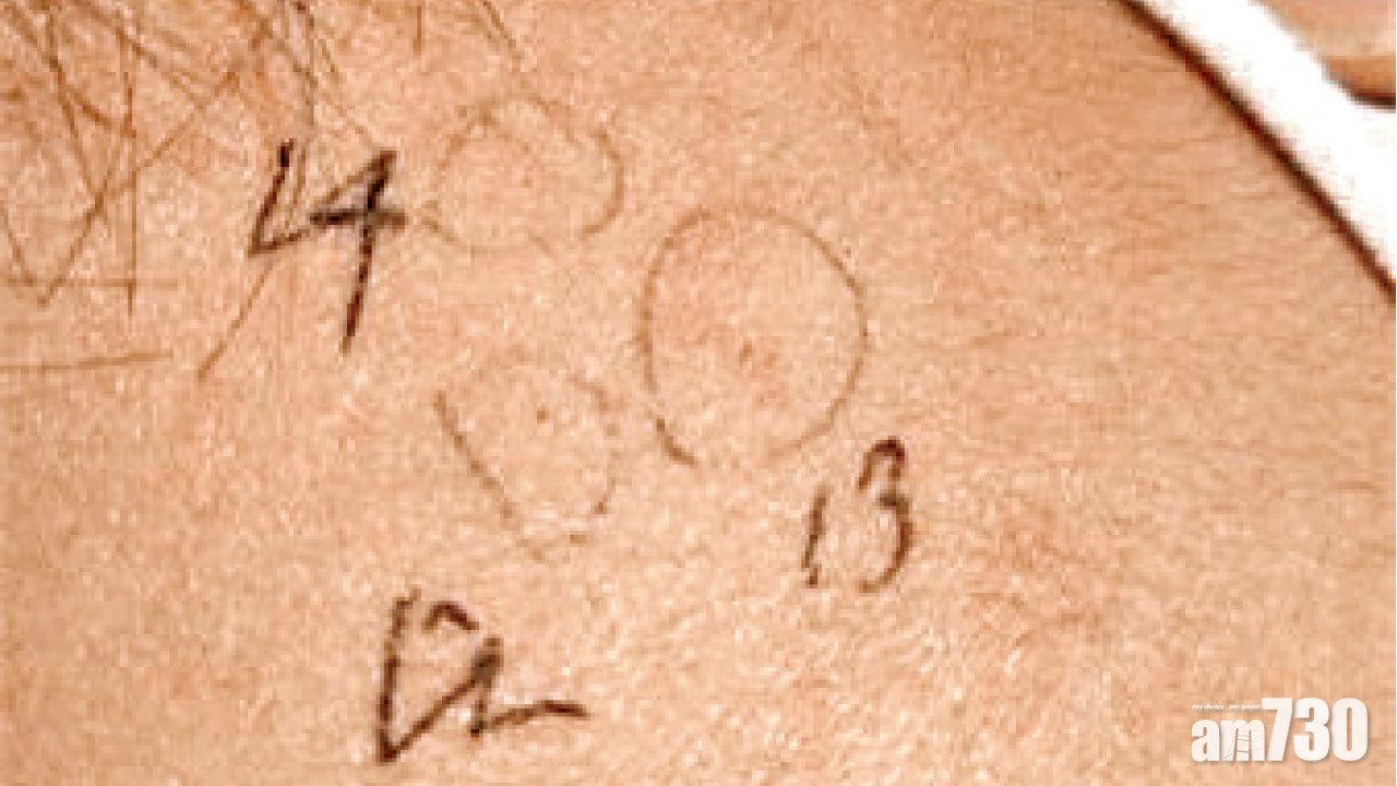 內蒙幼兒園老師 涉針拮餵藥虐童