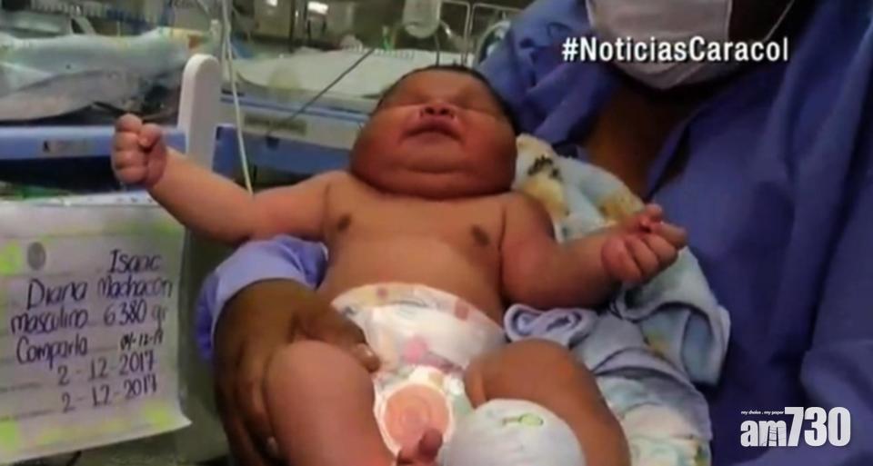 哥倫比亞婦誕14.1磅巨嬰  要用5個月大BB尿片