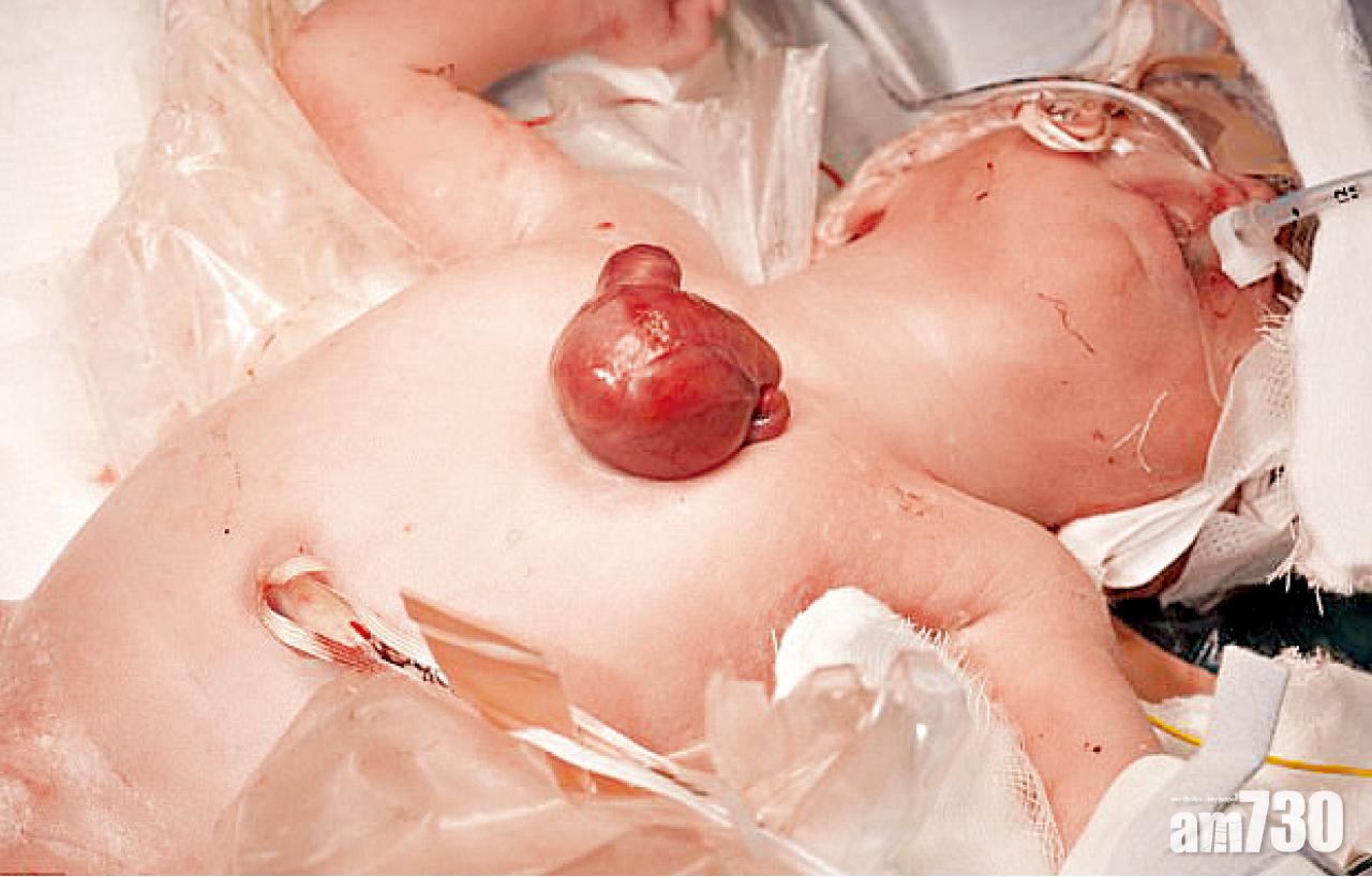 裸心嬰喜中100萬分8彩數