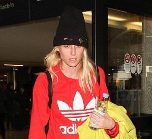 用衛生棉條中毒 美模恐再截肢