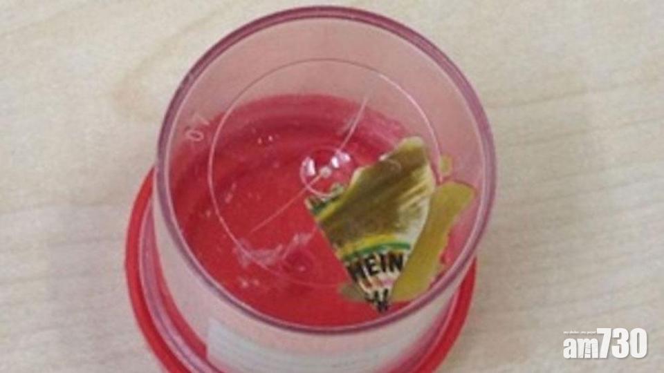 醫腸炎6年 始知吞進包裝茄汁碎片