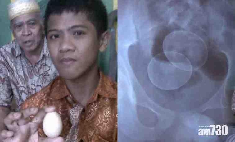 【人都識生蛋？】 少年自稱兩年產20隻雞蛋