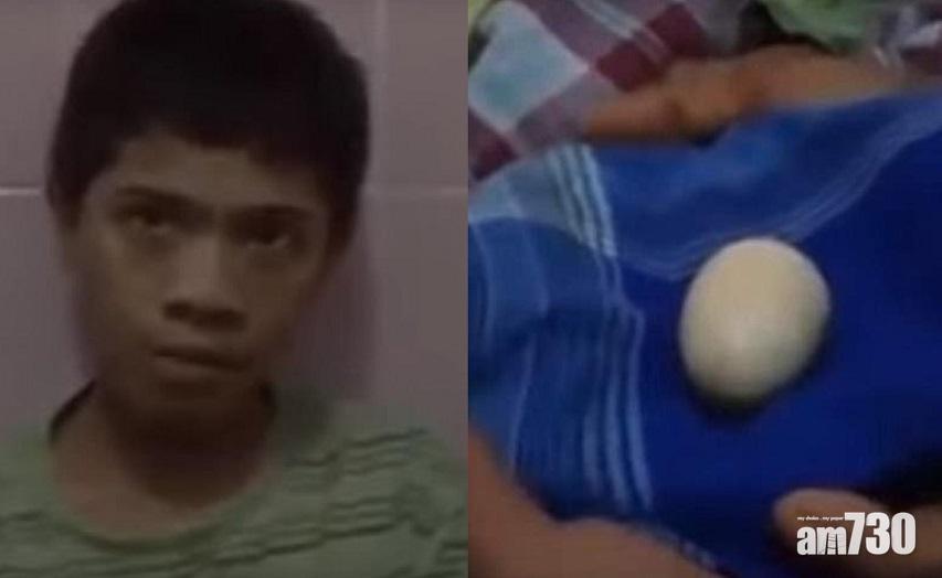 【人類識生蛋？】印尼少年誕下20隻蛋