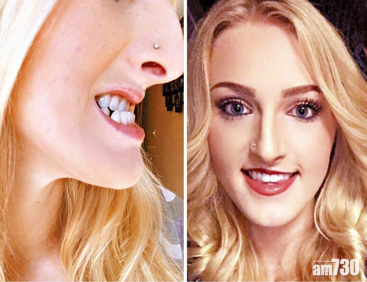 巫婆矯顎變仙女