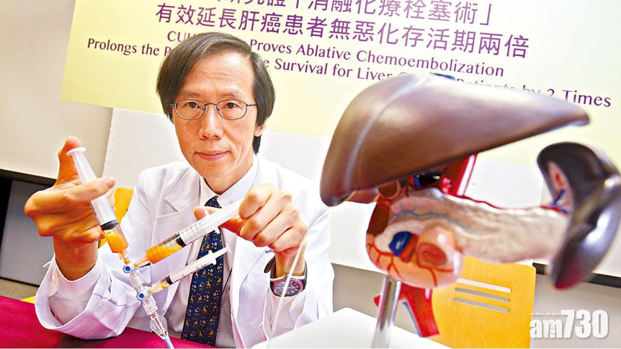 中期肝癌新療法 新栓塞術減復發率