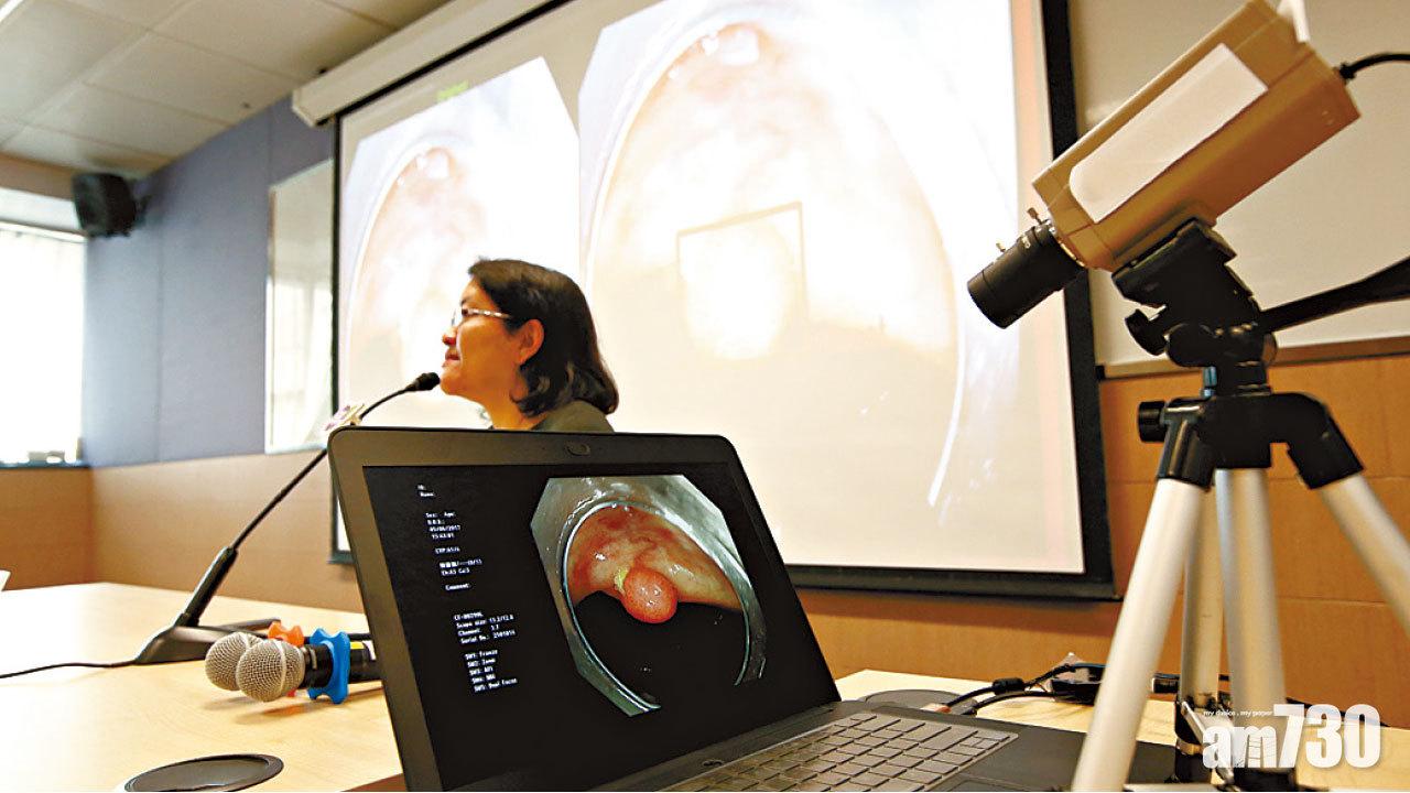中大研智能診斷系統 實時辨腸息肉 減漏檢誤判