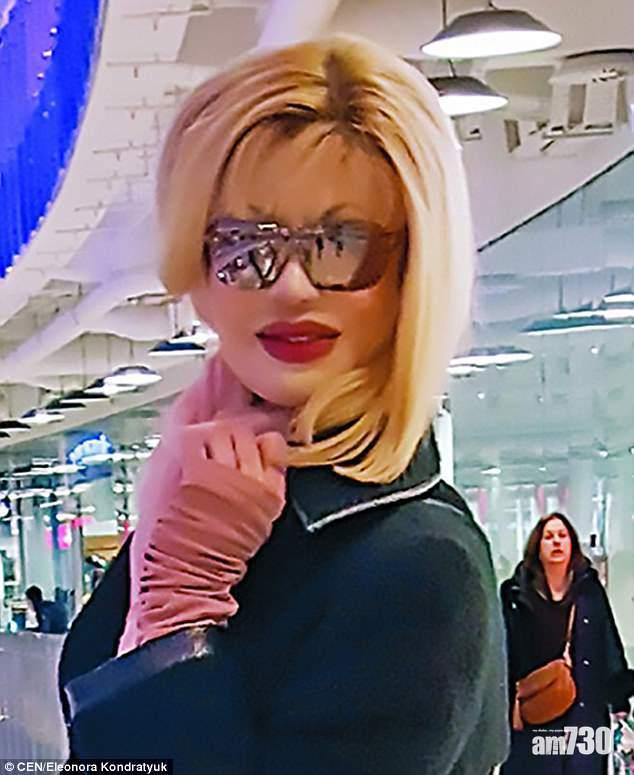 【拒絕消沉】被潑鏹毀容 選美亞軍200次整容還原靚樣