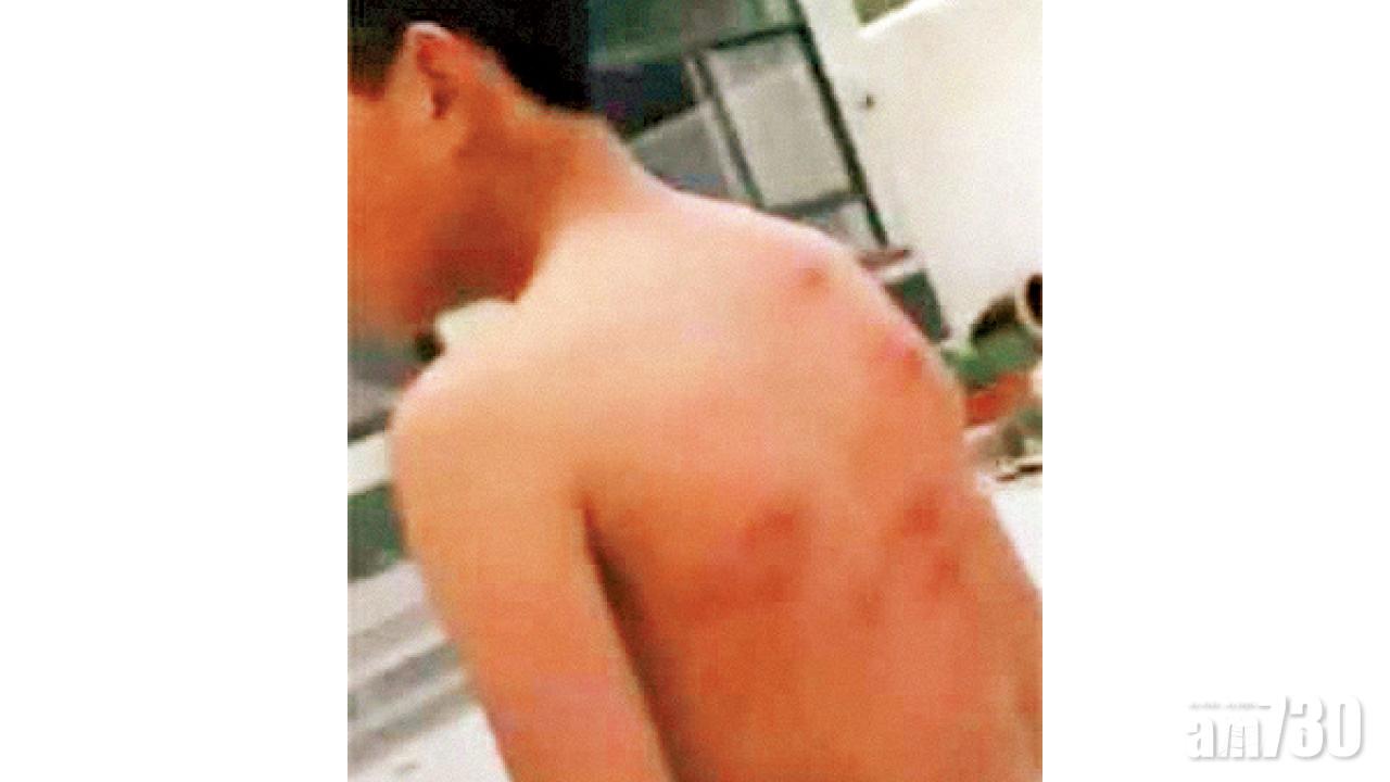 遺失平板電腦 12歲仔遭狠母拍片毒打