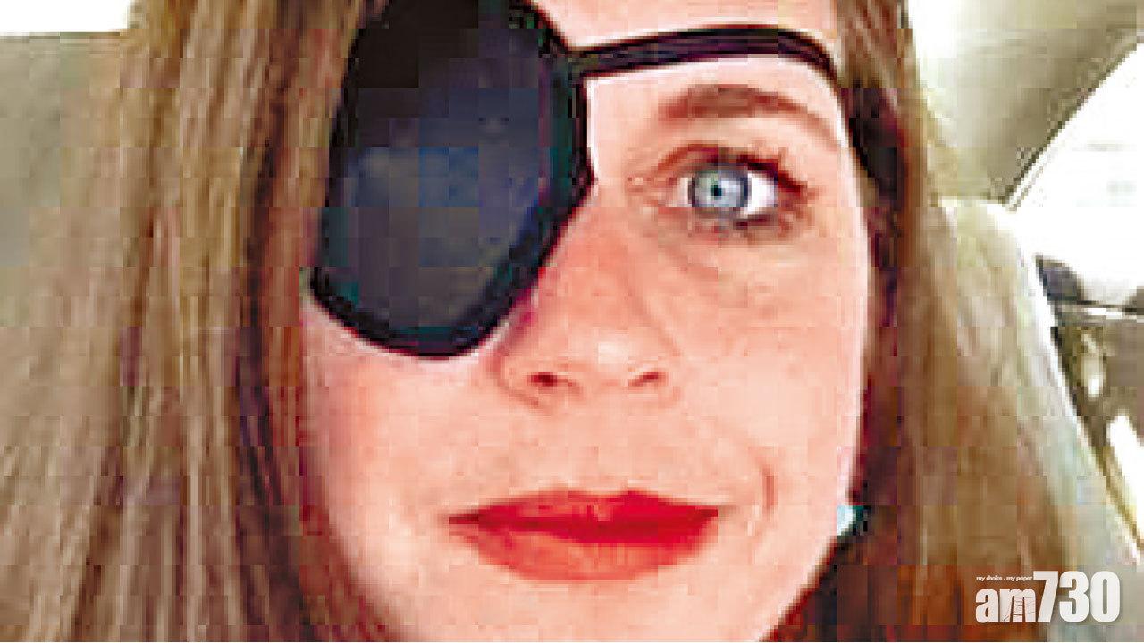 美大學36人患眼癌 