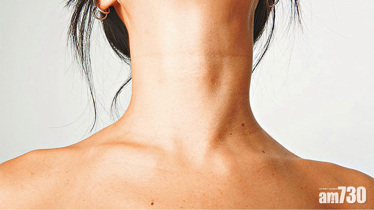 甲狀腺現腫塊 切除非一了百了