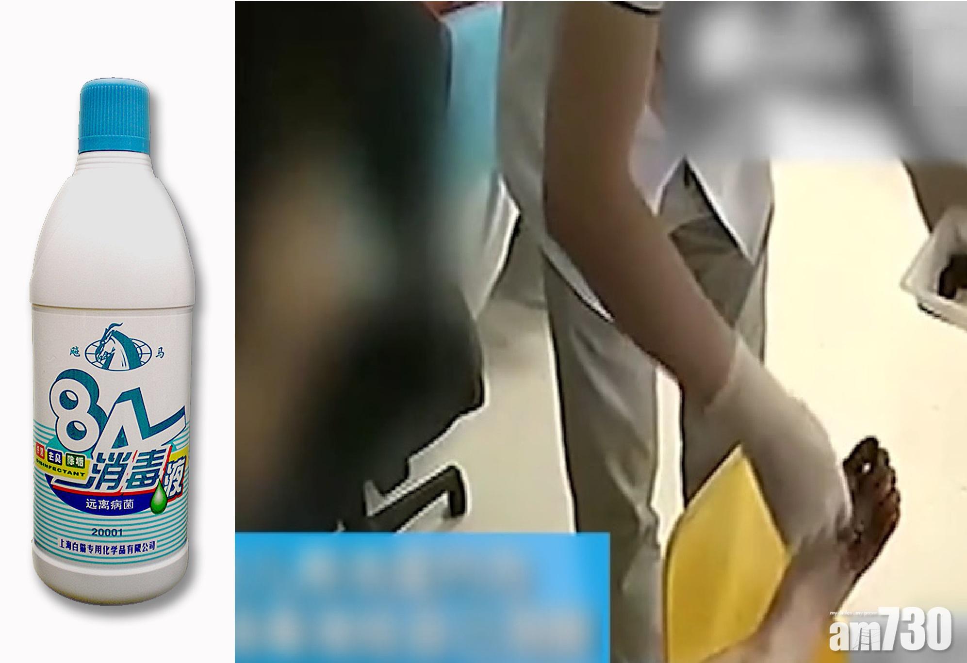 高濃度消毒水浸香港腳 湖北女害母失腳趾