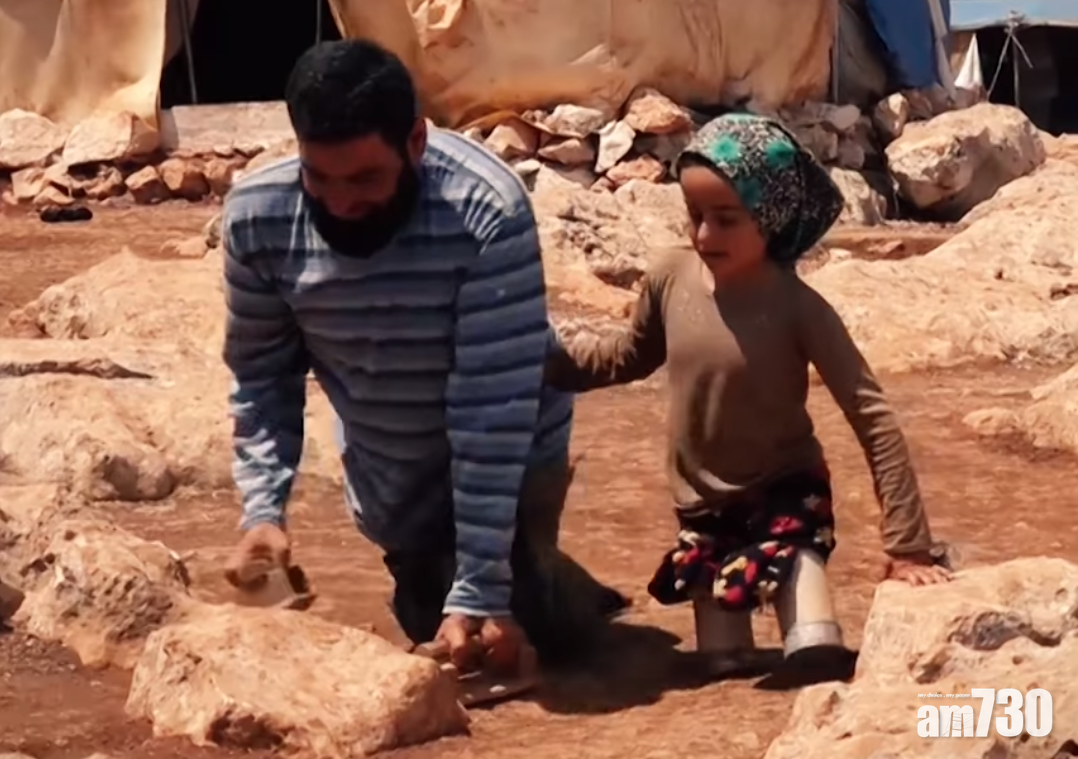 【好人好事】敘女童罐頭當義肢 仁醫免費治療