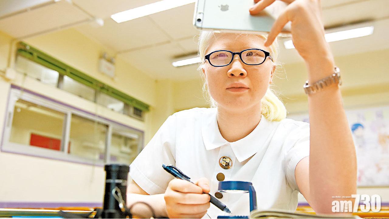 一成視力 八星佳績  弱視女生：勿怕眼前陰影