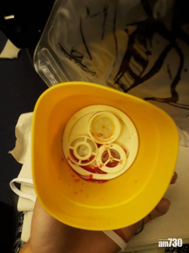 【耳膜險爆】客機失壓急降8000米 乘客耳鼻出血 (有片)