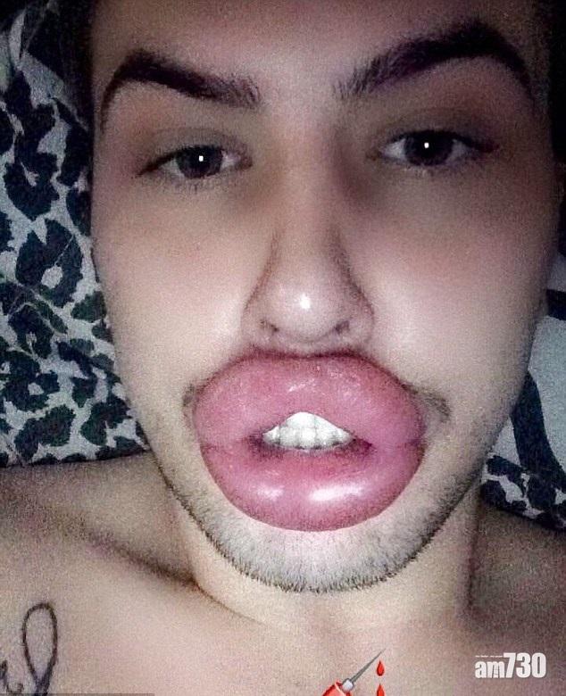 櫻唇男貪慕巨膶腸