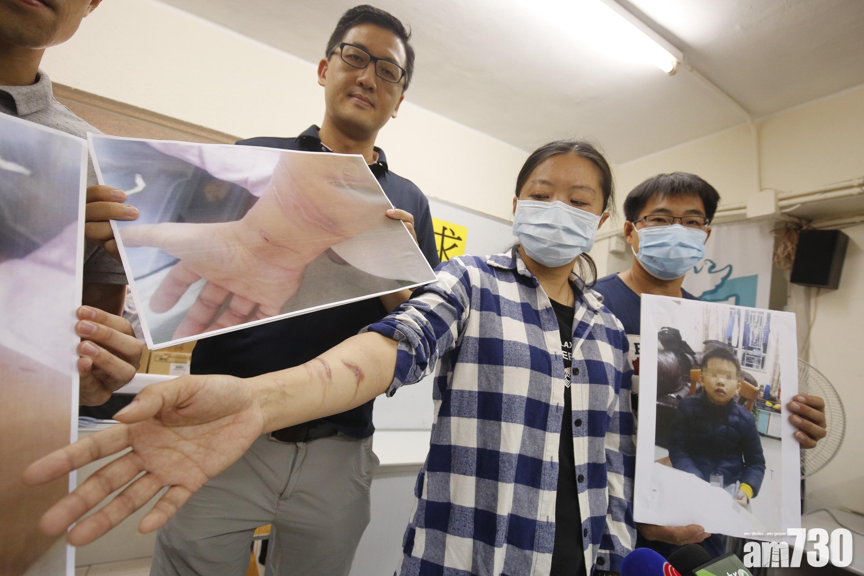 淋鏹水案拉人搜出鏹水　警方6月稱證據不足放生