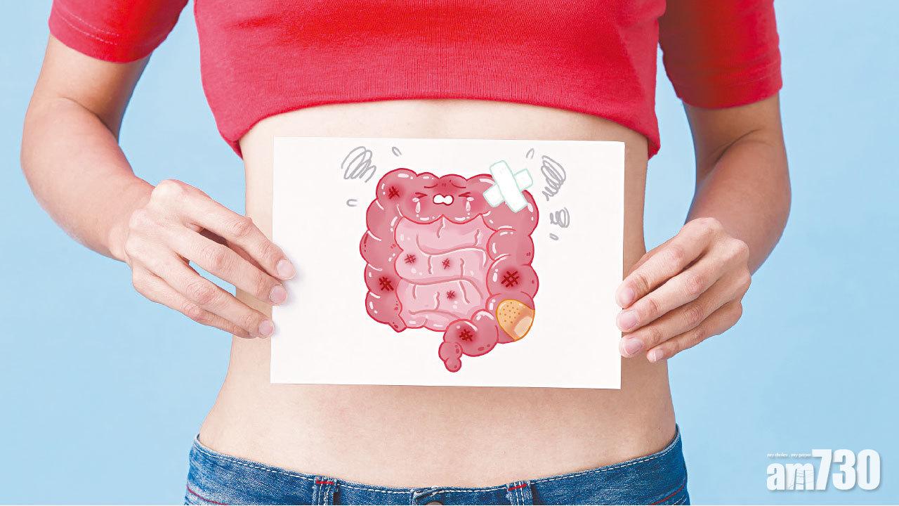 內窺鏡檢查預防大腸癌