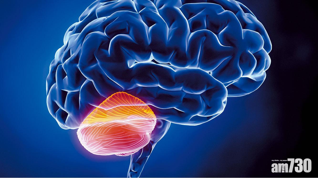 小腦萎縮症藥研新方向 