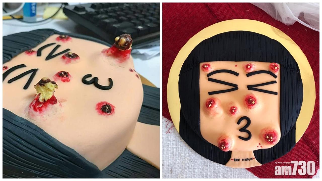 擠痘痘蛋糕 玩完仲有無胃口食？