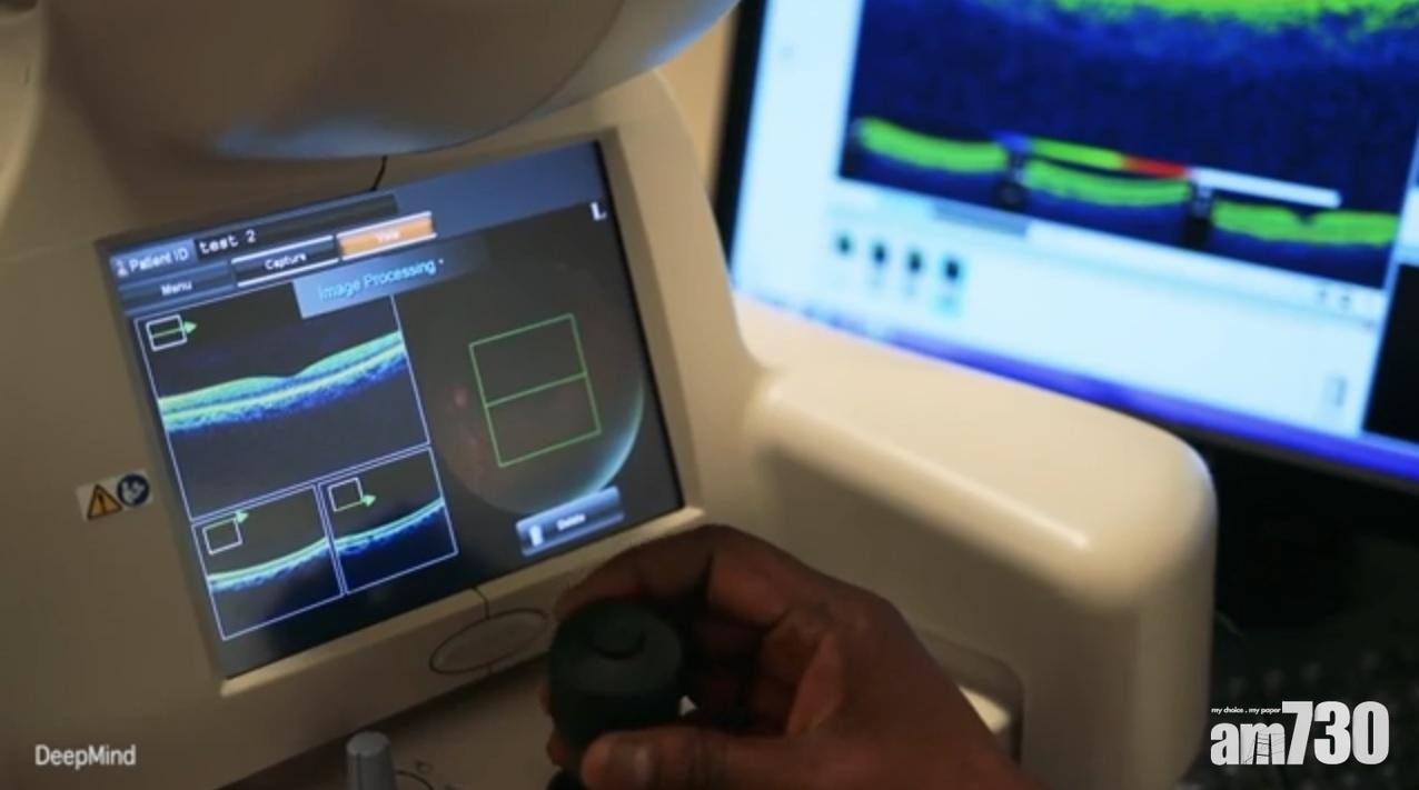 Google研究：AI診斷眼疾準繩度與權威專家不相伯仲