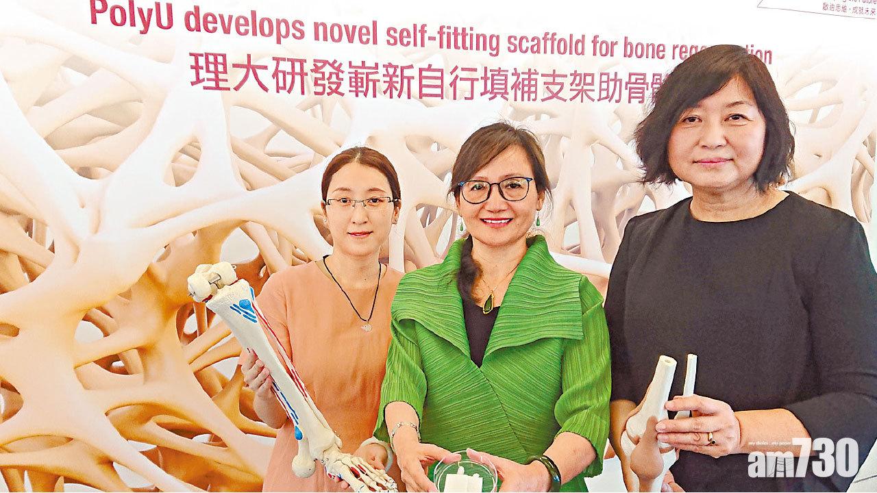 記憶支架 加速骨骼再生