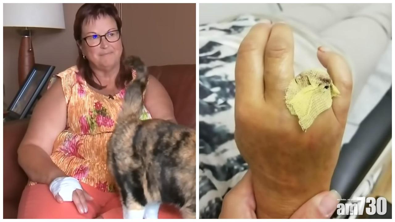 【望都痛】玩滑水梯無除戒指  手指監生被扯斷(有片)