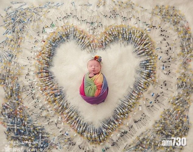 4年3小產 千支針寶寶