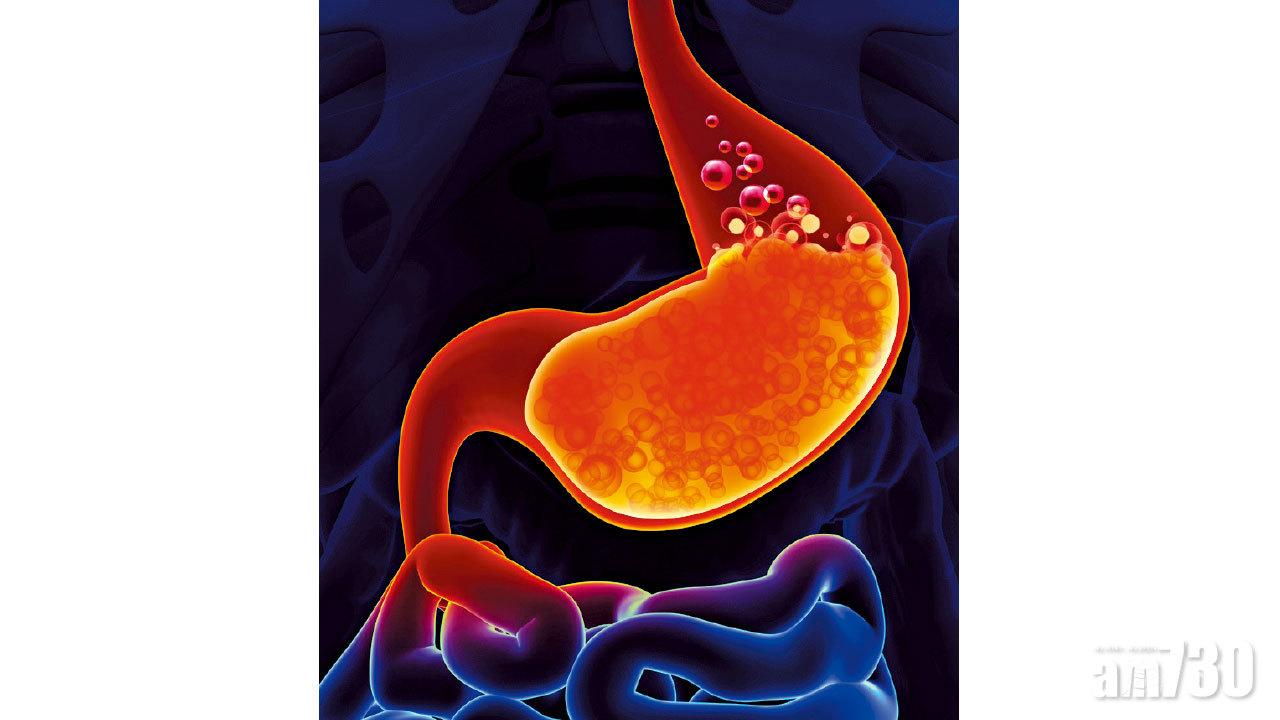 賁門失功能 一食就嘔