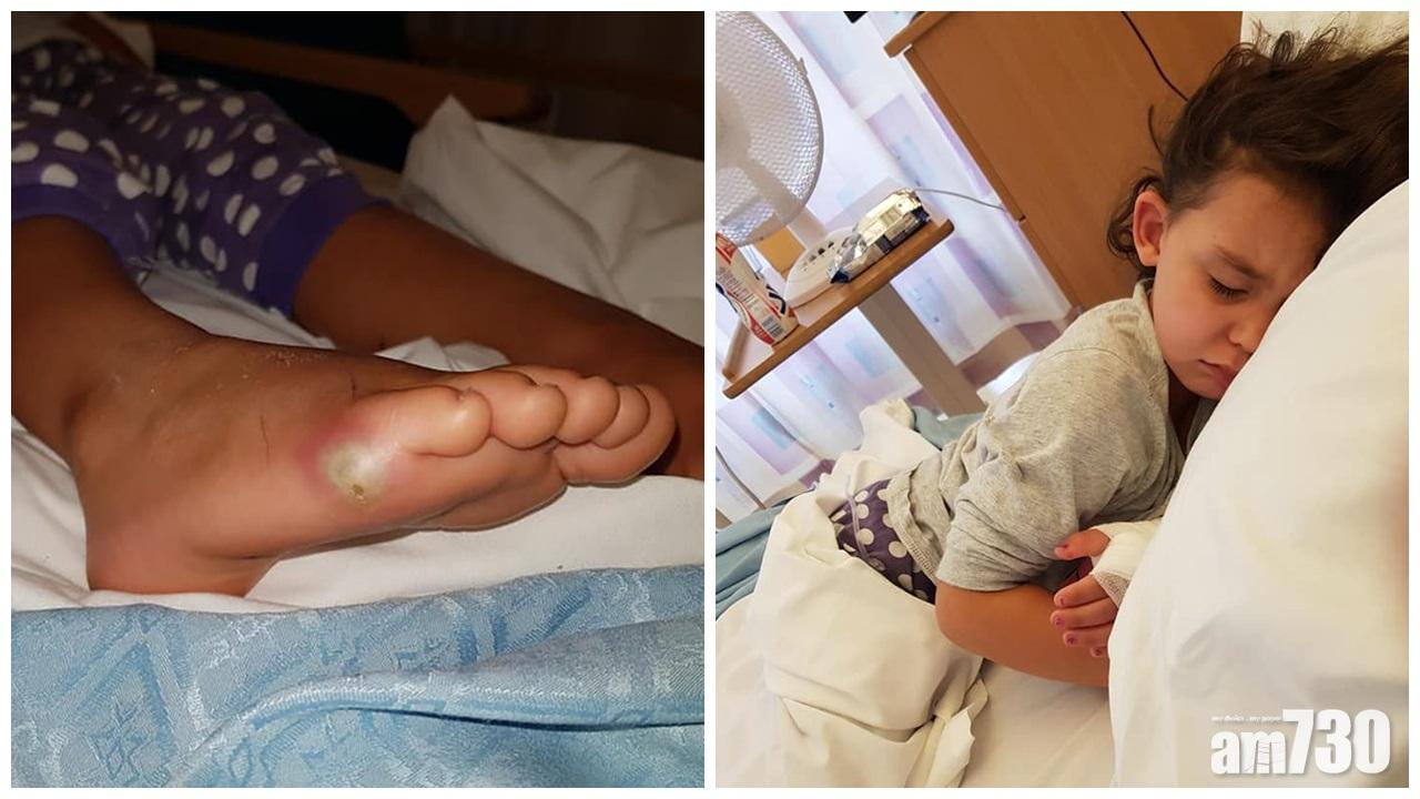 【父母注意】4歲英童試新鞋染敗血症險喪命