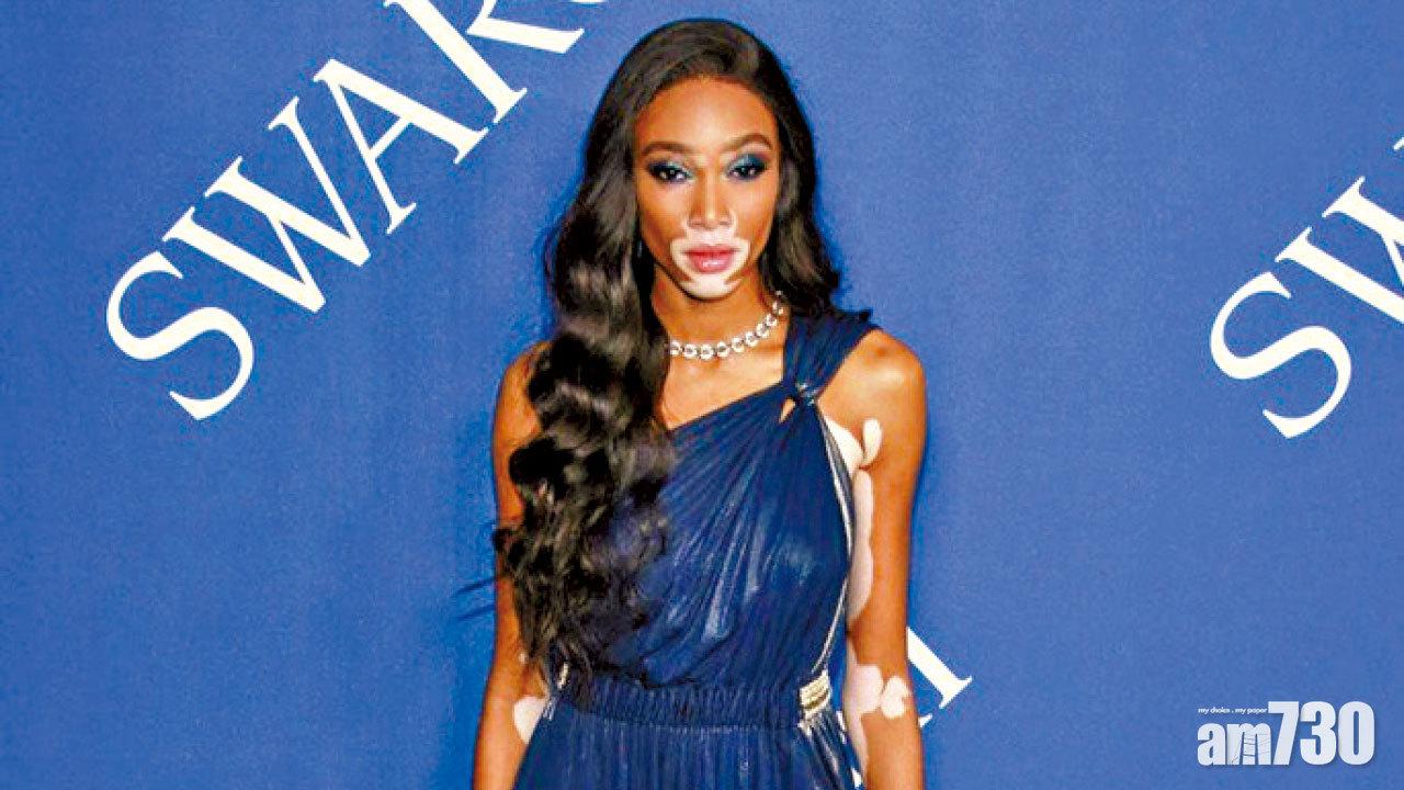 斑臉名模獲邀行VS騷