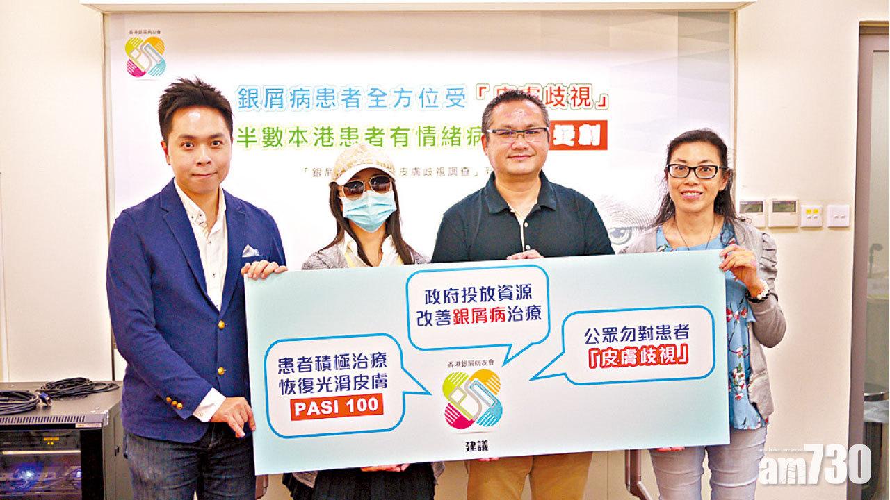 銀屑病 有得救