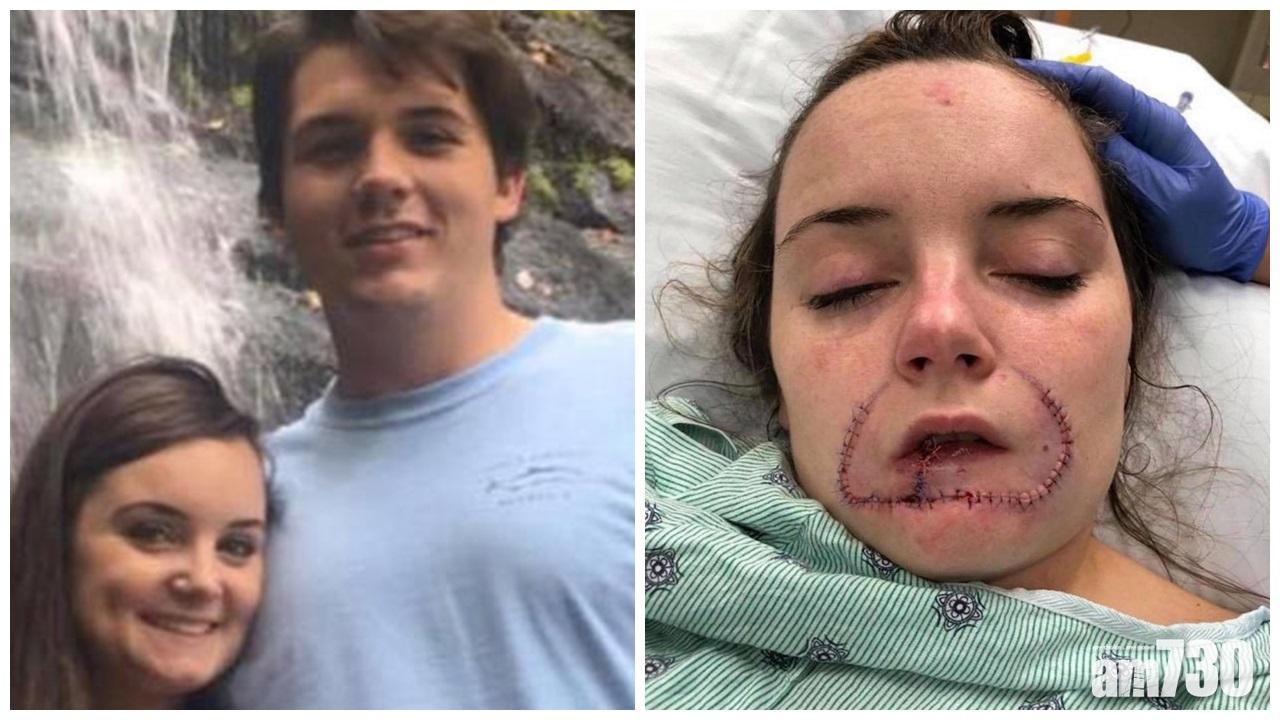 17歲少女拒復合下唇被咬掉  狠男判囚12年