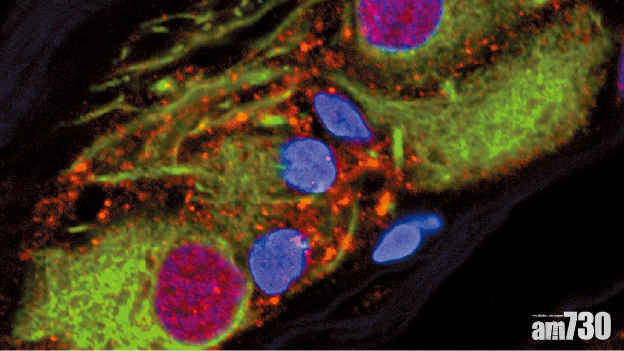 儲存特定蛋白質 盲腸或是柏金遜症根源