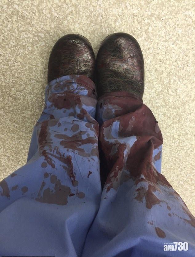 【槍管】上載褲鞋沾滿受害人鮮血相  醫生控訴槍械暴力 