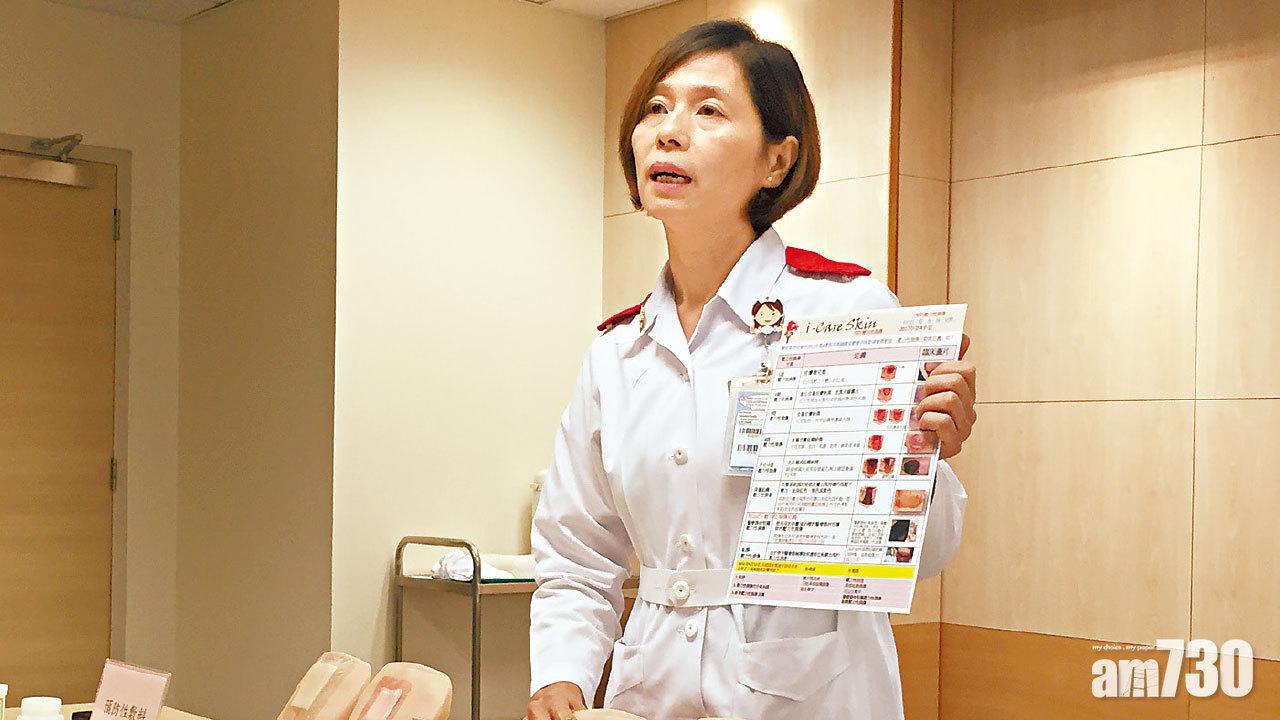 病者長時間維持同一姿勢易有壓瘡