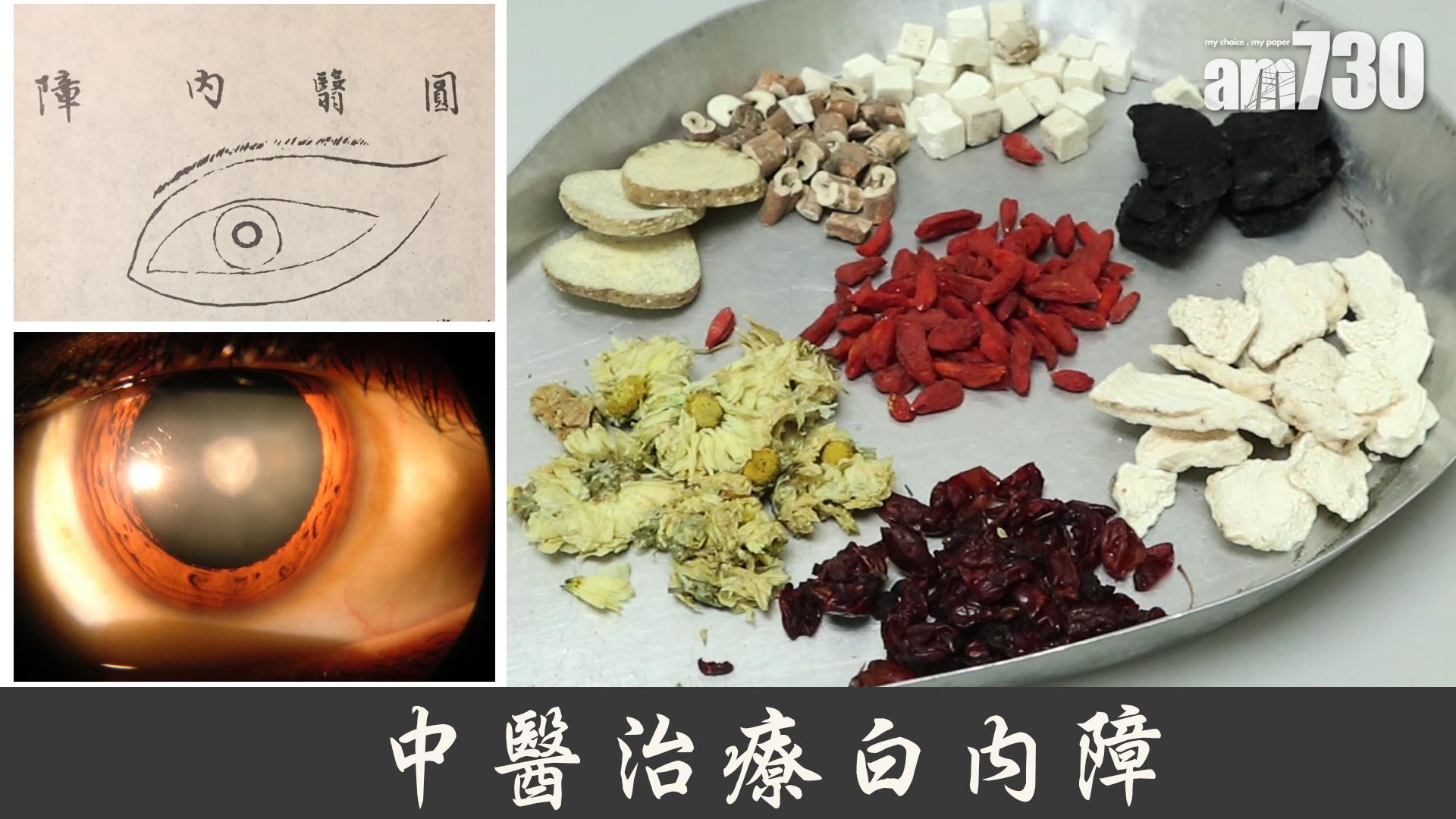 中醫治療白內障