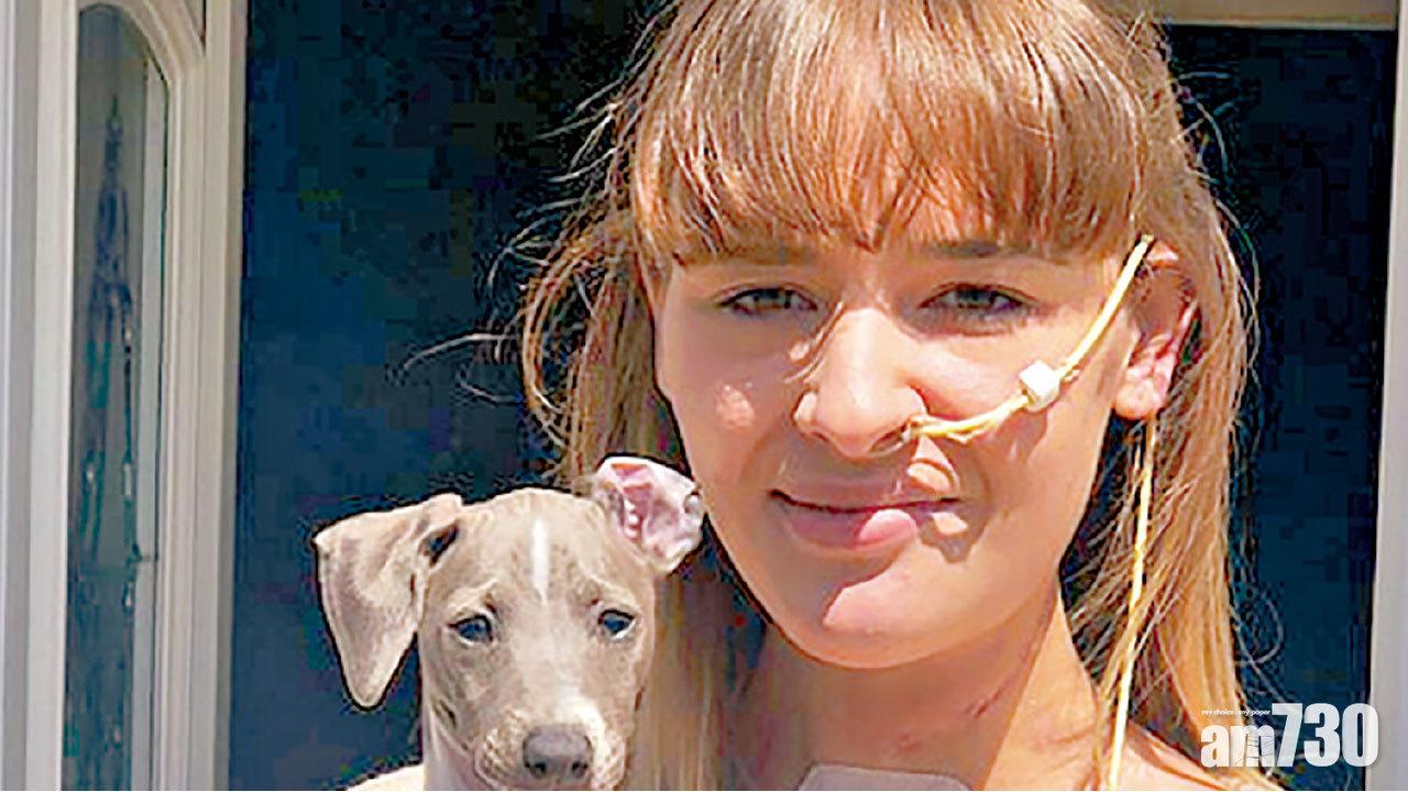 生痱滋以為小事 21歲女患口腔癌