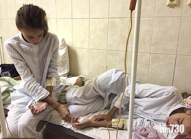 【顴骨唔夠凸】孖女減肥變骷髏