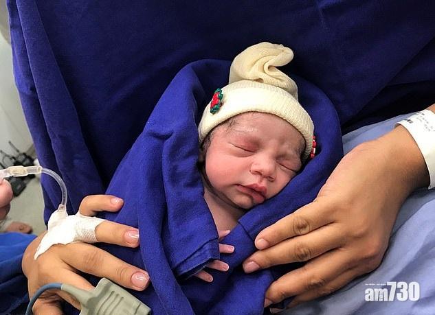 【全球首例】移植死者子宮 巴西婦成功誕下女嬰