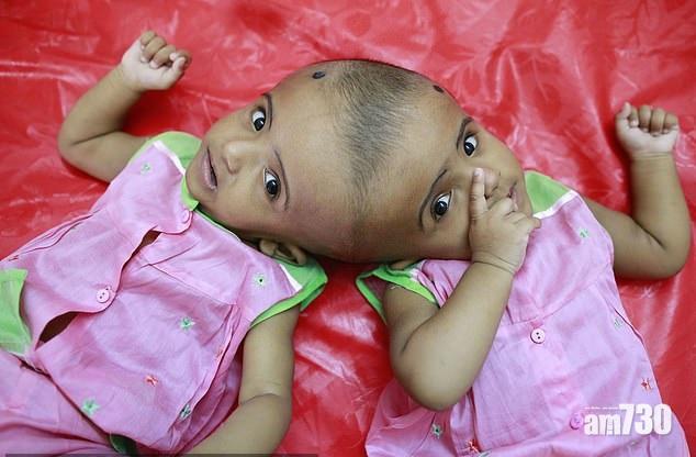 【終極一切】五死一生的分割