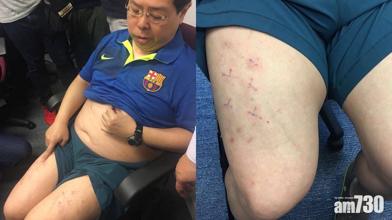 法醫質疑自製傷勢  林子健涉虛報被裁定表證成立