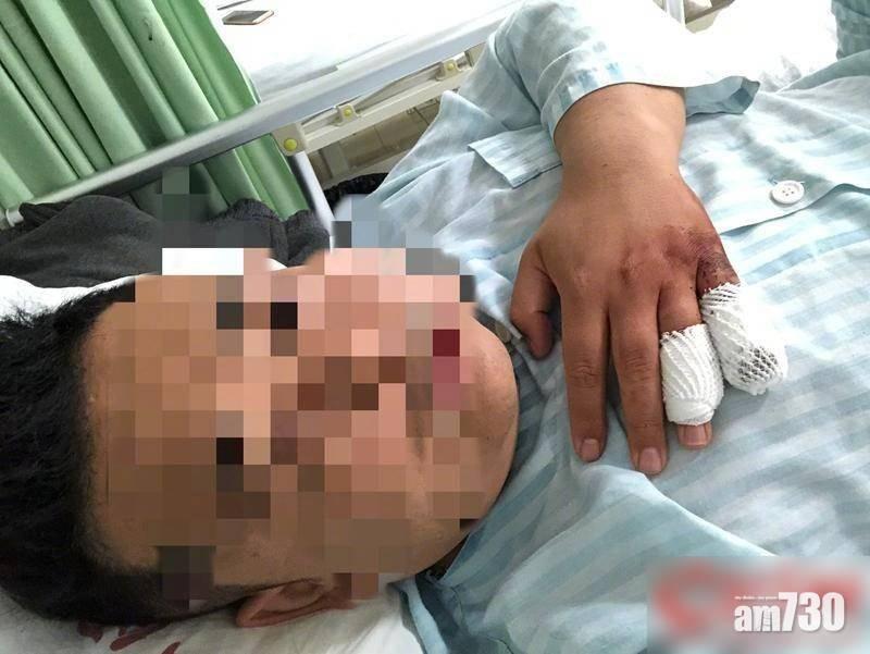 網約車司機坐地起價 乘客拒絕遭斬手指